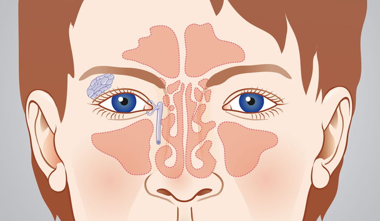 Nasennebenhöhlen Teaserbilder