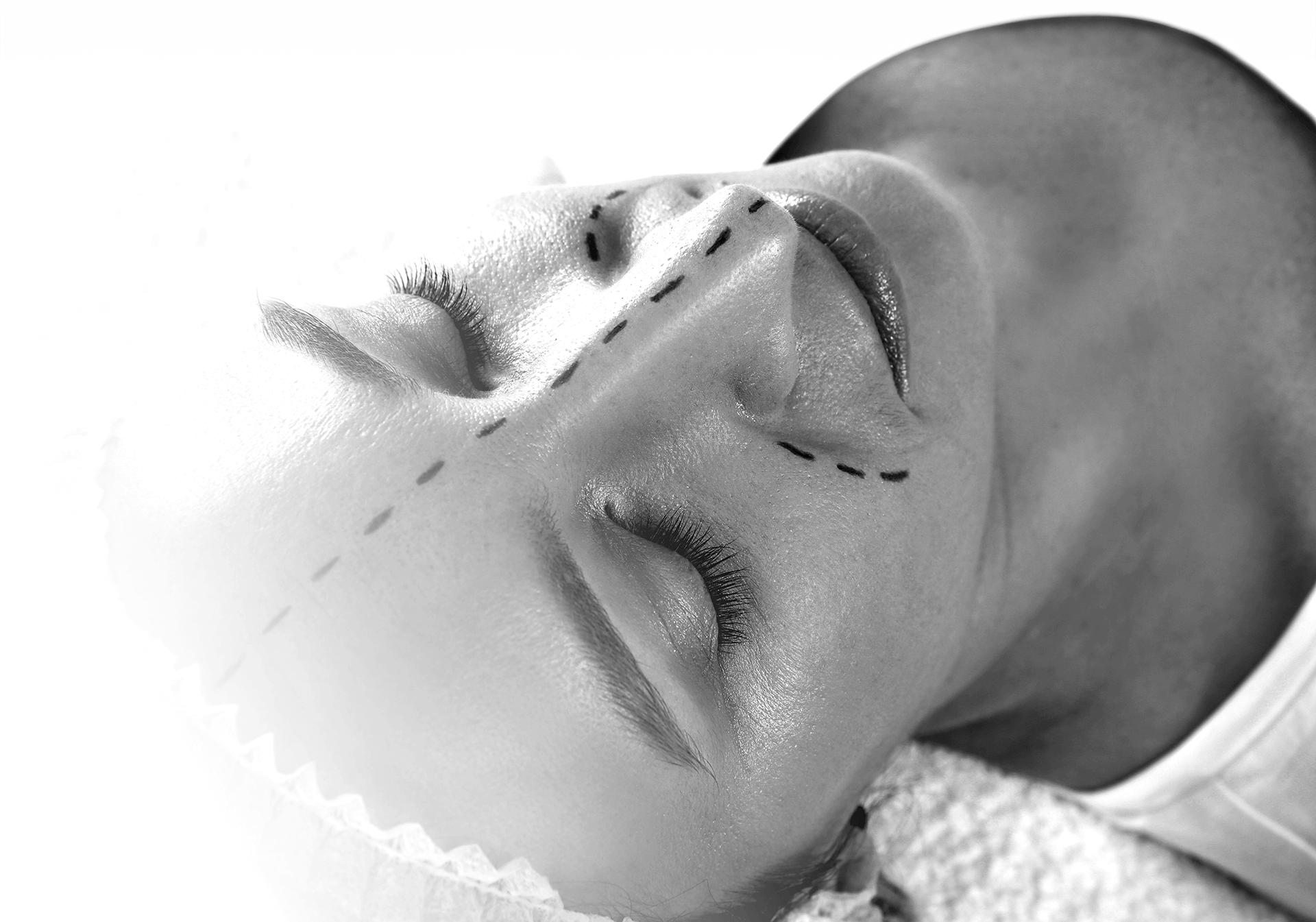 Vorbereitung der Patientin vor einer Nasen-OP