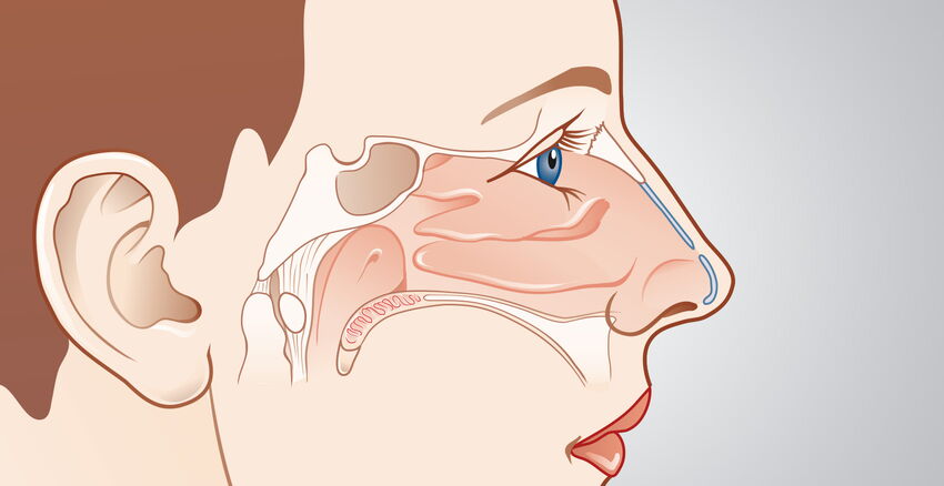 Spezielle Nasenchirurgie Headerbild