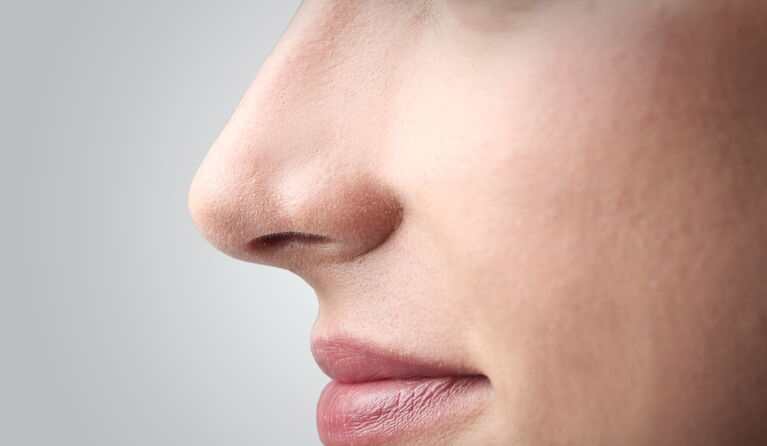 Teaserbild zu Funktionell-ästhetische Nasenkorrekturen - Septorhinoplastik