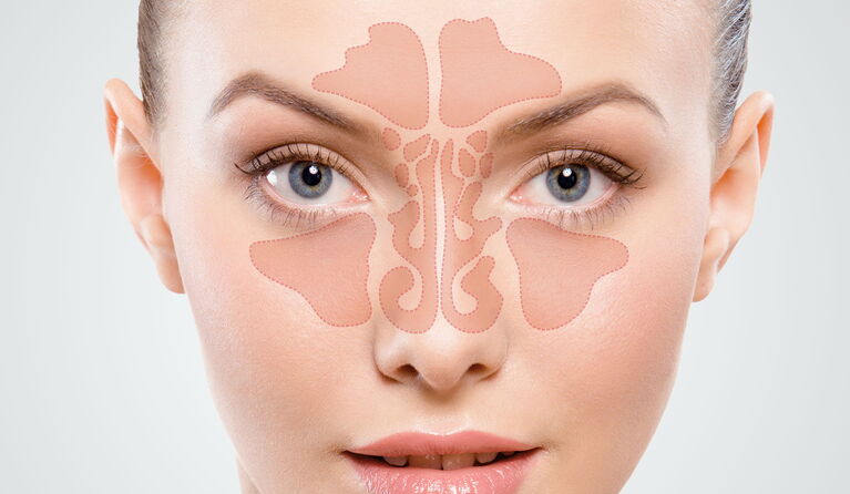 IhreNasennebenhöhlen machen schon seit Jahren Schwierigkeiten? Außerdem stören Sie sich schon lange am Erscheinungsbild Ihrer äußeren Nase? Wir prüfen für Sie, ob eine Nasennebenhöhlen-OP mit der äußeren Nasenkorrektur kombinierbar ist und führen den Eing