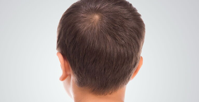 Ohrläppchen anlegen Teaserbild