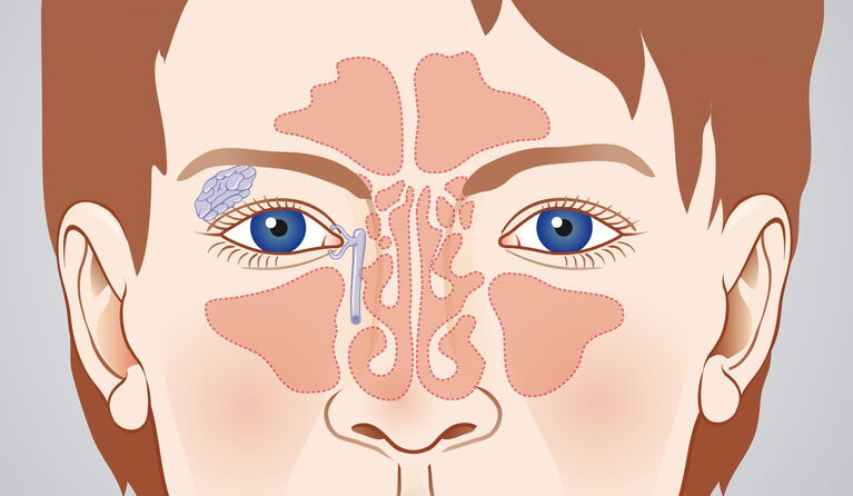 Tränenweg Teaserbild