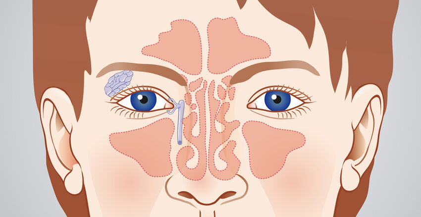 Nasennebenhöhlen Headerbild