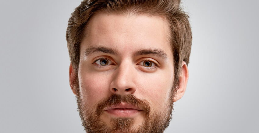 Beispiel für eine krumme Nase oder Schiefnase