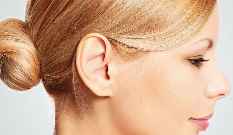 Verkleinerung der Ohren Teaserbild